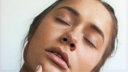 What Causes Acne? 10 Key Triggers. Which Is Yours?